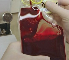 kmenové buňky a pupečníkovou krev